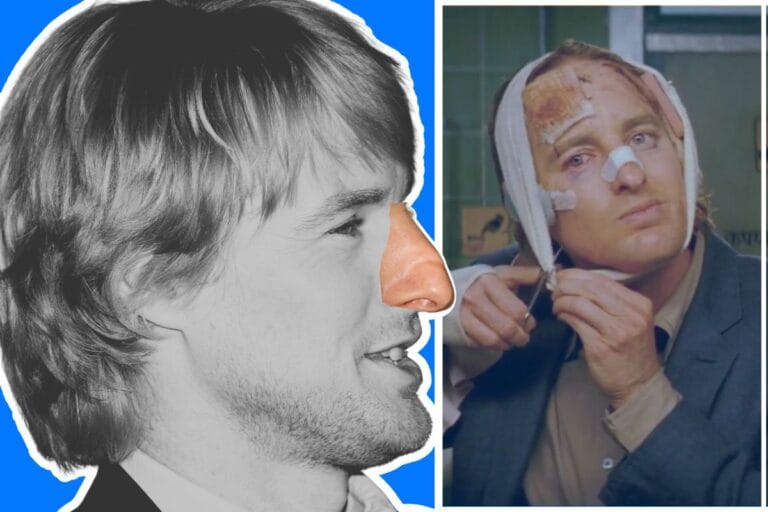 Owen Wilson Nose
