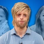 Celebrities with Treacher Collins Syndrome