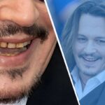 johnny depp teeth