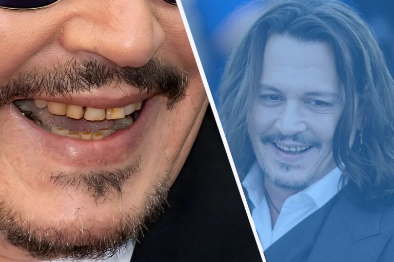 johnny depp teeth