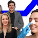 Celebrities Who Had Rhinoplasty