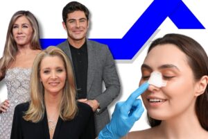 Celebrities Who Had Rhinoplasty