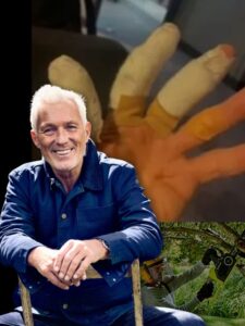 Martin Kemp Taken to Hospital After Scary Moment at Home