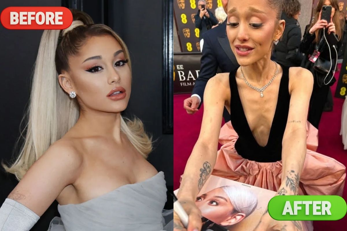 Ariana Grande before and after