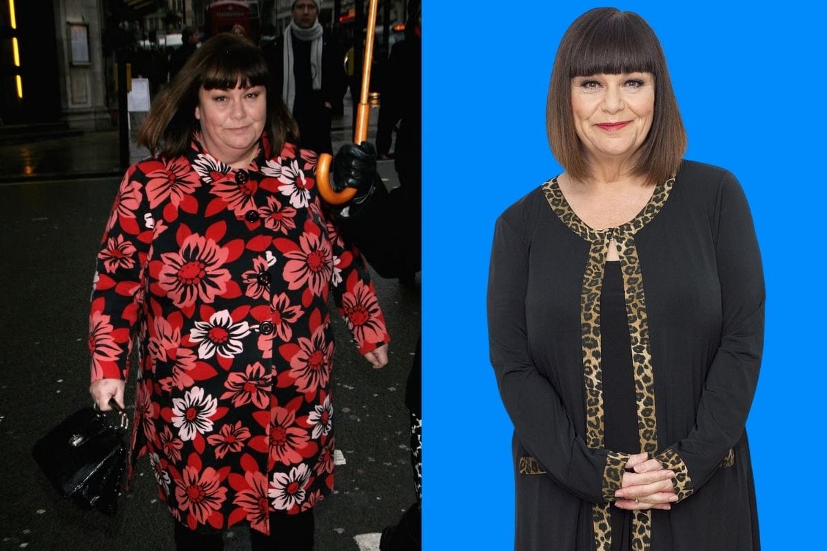 Dawn French weight loss before and after