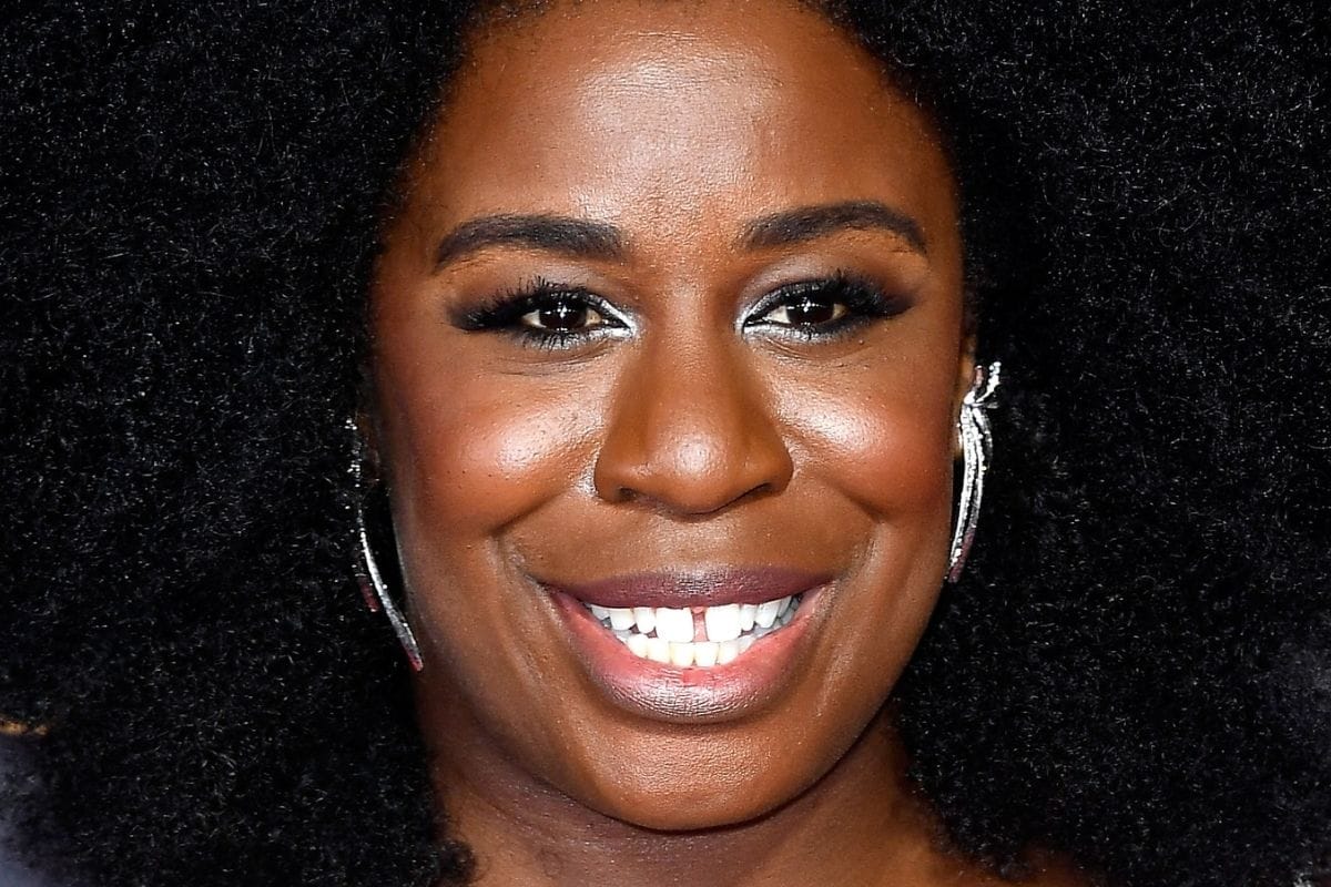 Uzo Aduba crooked teeth