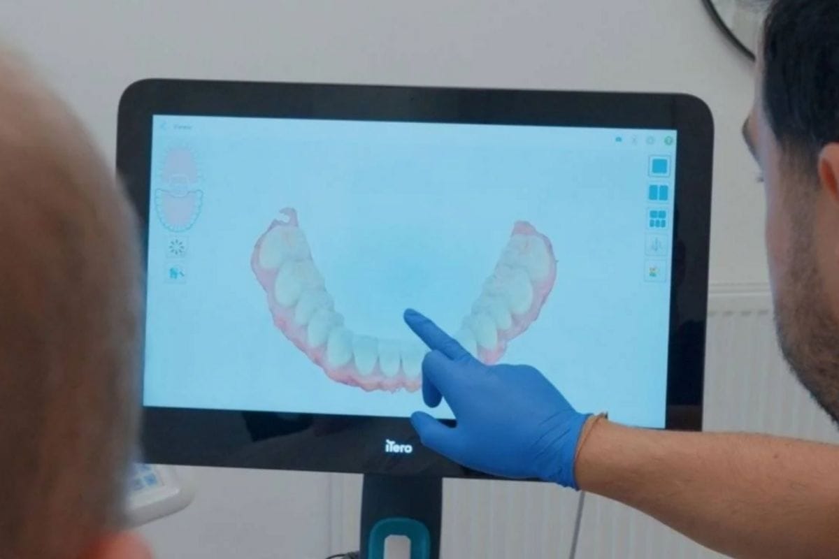 clear braces instead of traditional orthodontics